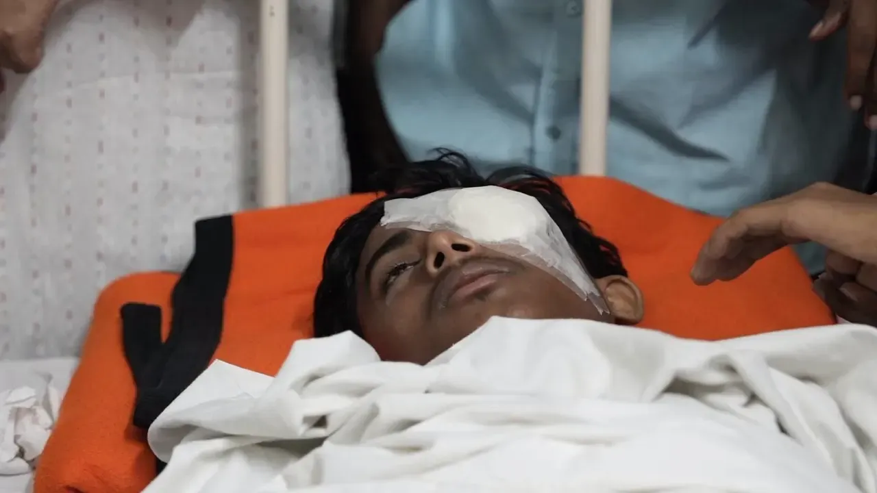 হবিগঞ্জে এনসিপির কর্মসূচিতে আহত আলিফের এক চোখের দৃষ্টিশক্তি আর ফিরবে না