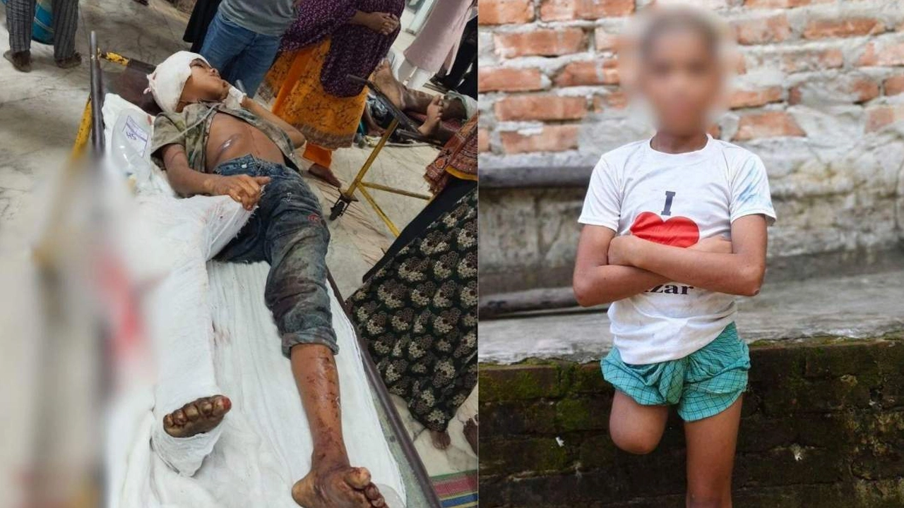 ট্রেন দুর্ঘটনায় আহত হওয়ার পর রায়হানের পা কাটা হয়